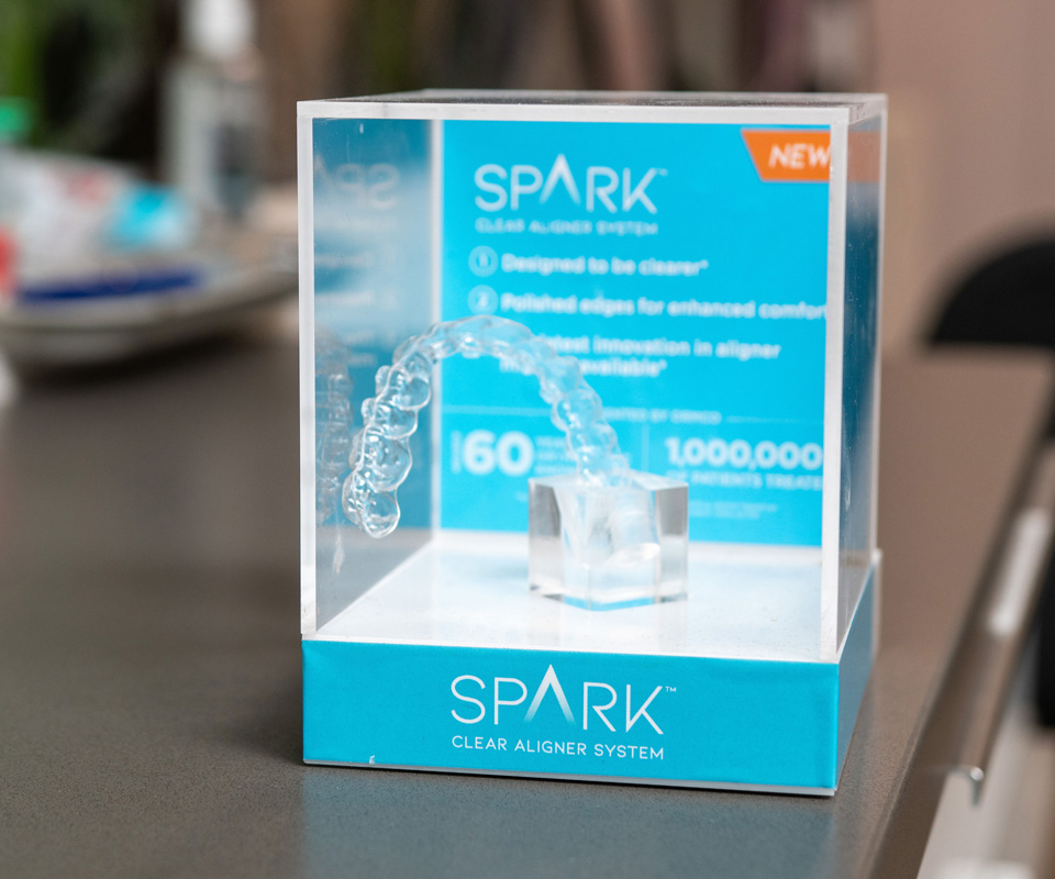 What are Spark aligners?
